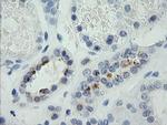 MDM4 Antibody in Immunohistochemistry (Paraffin) (IHC (P))