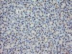 MDM4 Antibody in Immunohistochemistry (Paraffin) (IHC (P))