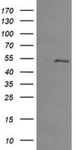 MDM4 Antibody in Western Blot (WB)