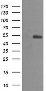 MDM4 Antibody in Western Blot (WB)