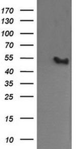 MDM4 Antibody in Western Blot (WB)