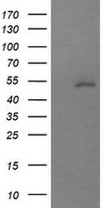 MDM4 Antibody in Western Blot (WB)