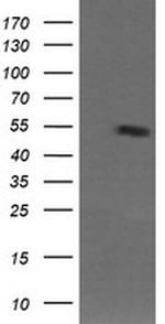 MDM4 Antibody in Western Blot (WB)