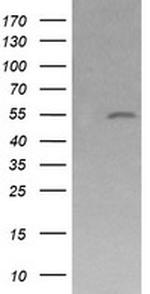 MDM4 Antibody in Western Blot (WB)