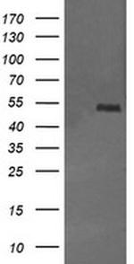 MDM4 Antibody in Western Blot (WB)