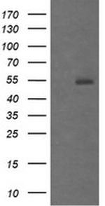 MDM4 Antibody in Western Blot (WB)