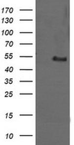 MDM4 Antibody in Western Blot (WB)