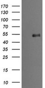 MDM4 Antibody in Western Blot (WB)