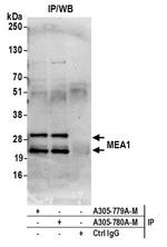 MEA1 Antibody in Immunoprecipitation (IP)