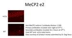 MeCP2 isoform 2 Polyclonal Antibody