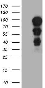 MECP2 Antibody in Western Blot (WB)