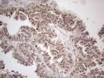 MED15 Antibody in Immunohistochemistry (Paraffin) (IHC (P))