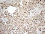 MED15 Antibody in Immunohistochemistry (Paraffin) (IHC (P))