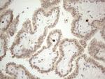 MED15 Antibody in Immunohistochemistry (Paraffin) (IHC (P))