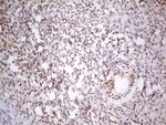 MED15 Antibody in Immunohistochemistry (Paraffin) (IHC (P))
