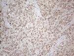 MED15 Antibody in Immunohistochemistry (Paraffin) (IHC (P))