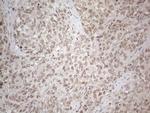 MED15 Antibody in Immunohistochemistry (Paraffin) (IHC (P))