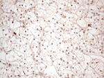 MED15 Antibody in Immunohistochemistry (Paraffin) (IHC (P))