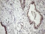 MED15 Antibody in Immunohistochemistry (Paraffin) (IHC (P))