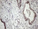 MED15 Antibody in Immunohistochemistry (Paraffin) (IHC (P))