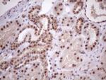 MED15 Antibody in Immunohistochemistry (Paraffin) (IHC (P))