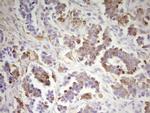 MED15 Antibody in Immunohistochemistry (Paraffin) (IHC (P))