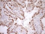 MED15 Antibody in Immunohistochemistry (Paraffin) (IHC (P))