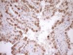 MED15 Antibody in Immunohistochemistry (Paraffin) (IHC (P))