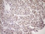 MED15 Antibody in Immunohistochemistry (Paraffin) (IHC (P))