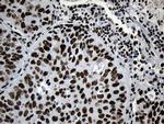 MED19 Antibody in Immunohistochemistry (Paraffin) (IHC (P))