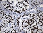 MED19 Antibody in Immunohistochemistry (Paraffin) (IHC (P))