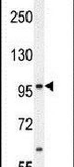 MED25 Antibody in Western Blot (WB)