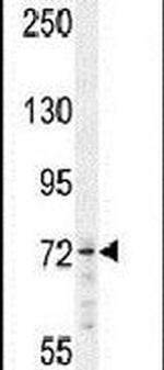 MED25 Antibody in Western Blot (WB)