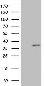 MED6 Antibody in Western Blot (WB)