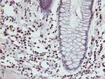 MEF2C Antibody in Immunohistochemistry (Paraffin) (IHC (P))