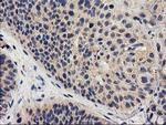 MEF2C Antibody in Immunohistochemistry (Paraffin) (IHC (P))