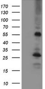 MEF2C Antibody in Western Blot (WB)