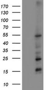 MEF2C Antibody in Western Blot (WB)