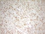 MEF2D Antibody in Immunohistochemistry (Paraffin) (IHC (P))