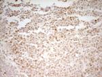 MEF2D Antibody in Immunohistochemistry (Paraffin) (IHC (P))