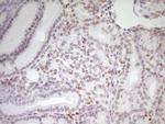 MEF2D Antibody in Immunohistochemistry (Paraffin) (IHC (P))