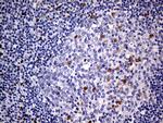 MEIS1 Antibody in Immunohistochemistry (Paraffin) (IHC (P))
