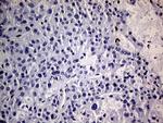 MEIS1 Antibody in Immunohistochemistry (Paraffin) (IHC (P))