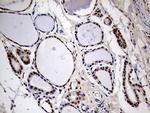 MEIS1 Antibody in Immunohistochemistry (Paraffin) (IHC (P))