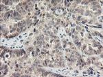 MEIS3 Antibody in Immunohistochemistry (Paraffin) (IHC (P))