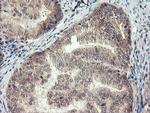 MEIS3 Antibody in Immunohistochemistry (Paraffin) (IHC (P))