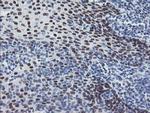 MEIS3 Antibody in Immunohistochemistry (Paraffin) (IHC (P))
