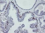 MEIS3 Antibody in Immunohistochemistry (Paraffin) (IHC (P))