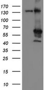 MEIS3 Antibody in Western Blot (WB)