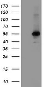 MEIS3 Antibody in Western Blot (WB)